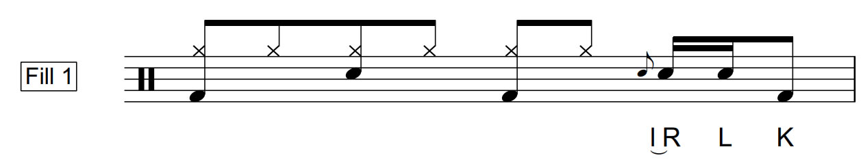 Inverted Flam Tap | Fill 1 | 40 BPM