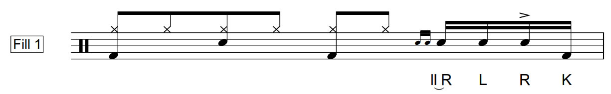 Lesson 25 | Fill 1 | 40 Bpm