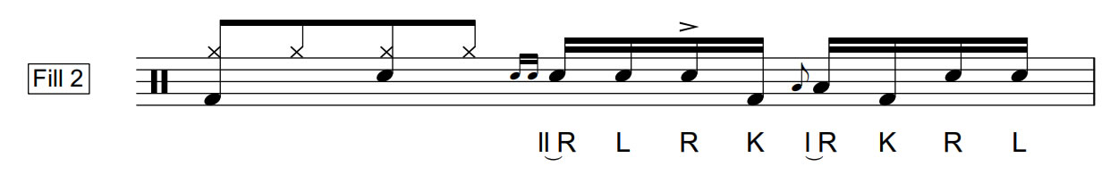 Lesson 25 | Fill 2 | 40 Bpm